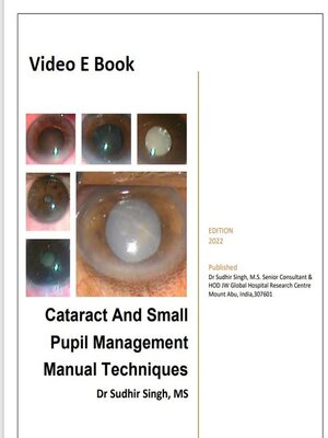 cover image of Cataract and Small Pupil Management Manual Techniques